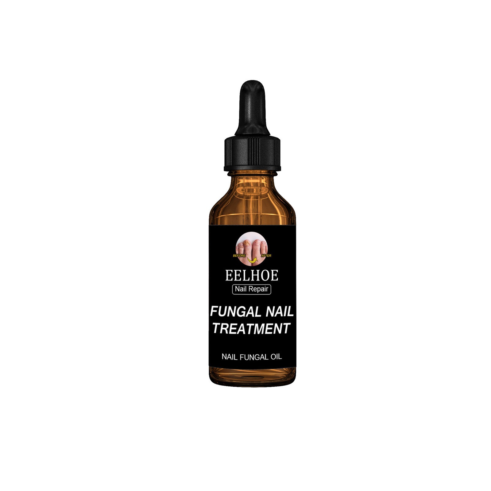Onychomycosis Dead Nail Treatment And Nail Repairing Lotion