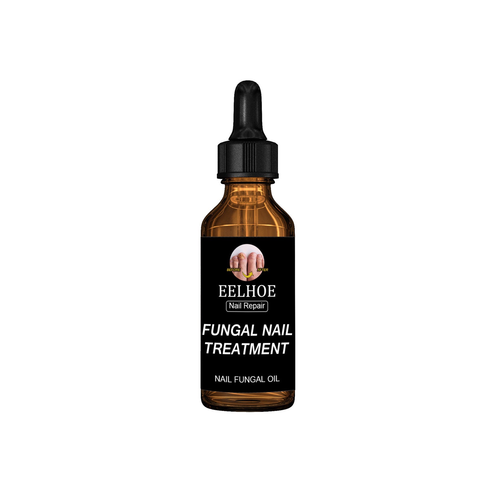 Onychomycosis Dead Nail Treatment And Nail Repairing Lotion