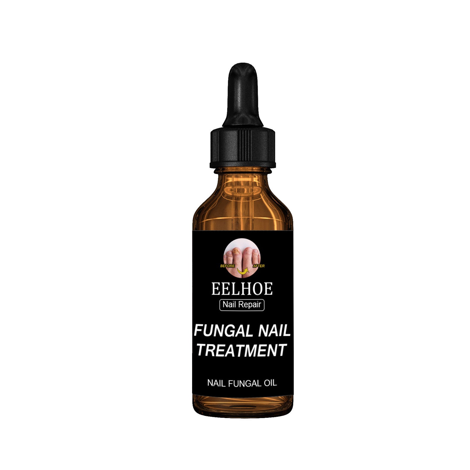 Onychomycosis Dead Nail Treatment And Nail Repairing Lotion