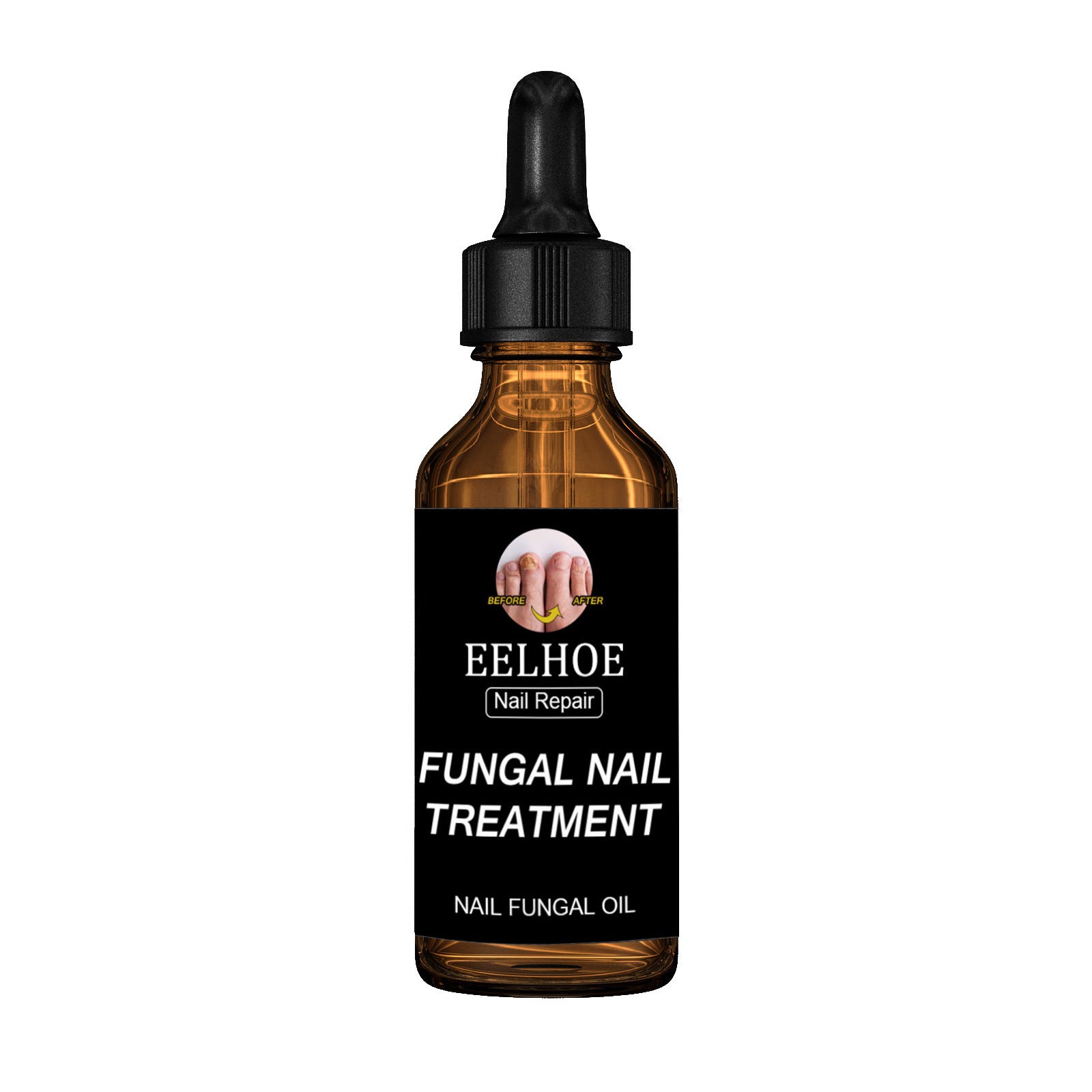 Onychomycosis Dead Nail Treatment And Nail Repairing Lotion